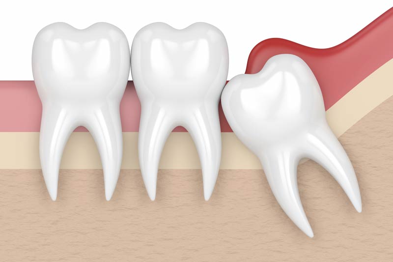 Restorative and Esthetic Dentistry in New York